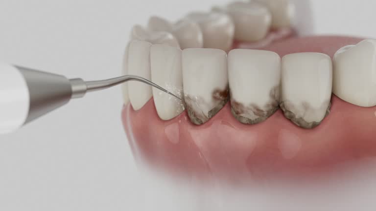 Reliable Teeth Whitening contractor in Sanilac County County, MI by Dentist Open Now
